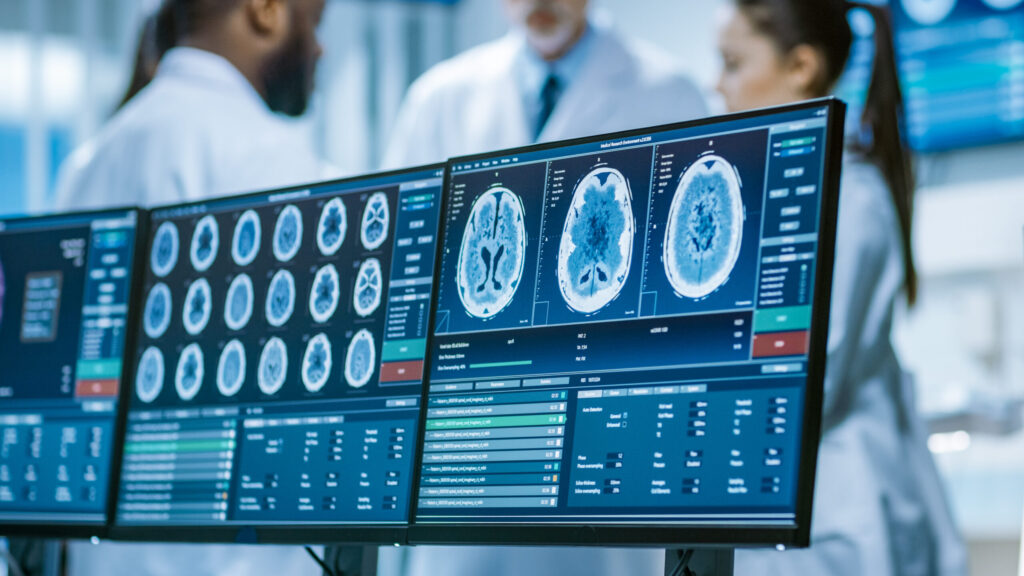 Computer,Screen,Showing,Mri,,Ct,Image,Scan,Of,The,Brain.